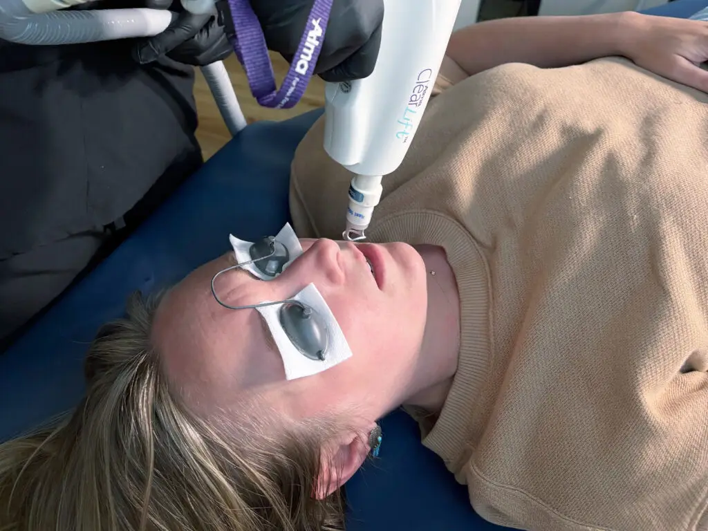 Client receiving ClearLift laser lip rejuvenation treatment at Instinct Holistic Medical Spa in Bozeman Montana